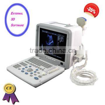 Factory price!CE approved Notebook B-Mode Ultrasound Scanner with 5.0Mhz multi-frequency micro-convex probe RUS-9000B