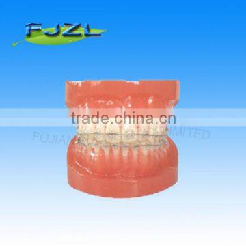 orthodontic teeth model(normal tooth, invisible brackets),dental orthodontic models