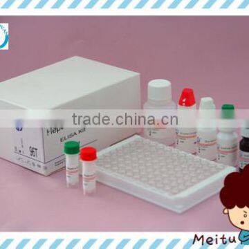 HBV Hepatitis B virus HBeAg ELISA test kit chemistry reagent