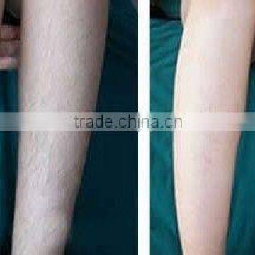 1064nm Mulfunction Beauty Machine:1064nm Long Pulsed ND Yag Laser For Hair Removal And Vascular Removal 800mj