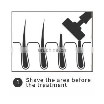 Ipl Home Use From Deess Ipl Home SPA Use Hair Removal & Skin Rejuvenation & Acne Clearance Machine photo-3