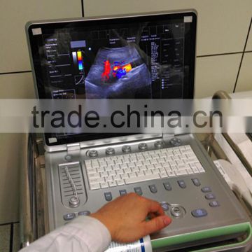 C7 KONTED 3D Portable Color Doppler Ultrasound                        
                                                Quality Choice