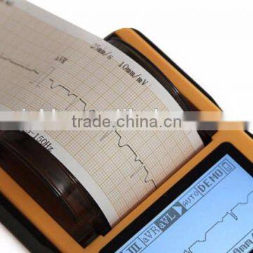Digital 1-channel Handheld Electrocardiograph ECG EKG Machine PC Based ECG Machine photo-6