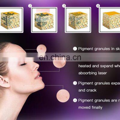 PicoSecond Laser 1064nm 532nm Birthmark Tattoo Removal nd Yag Spectra Laser Toning Melasma Facial Carbon Peeling Laser Machine photo-3