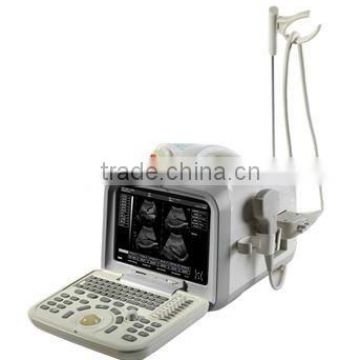 High Sensitivity USB Digital Ultrasound Scanner