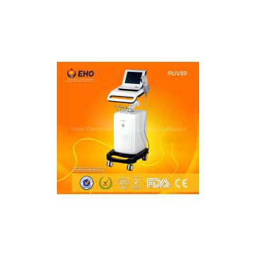 High Intensity !! RUV89 Best effect ultrasound machine hifu machine