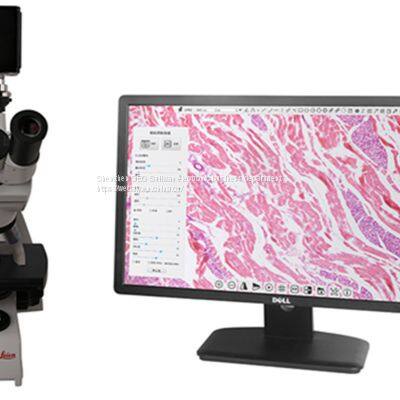 4K/1080P Adaptive Camera Industrial Camera Electron Microscope photo-4