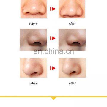 2020 Cheapest Skin Care Electric Nose Pore Vacuum Blackhead Remover Tool Kit photo-4