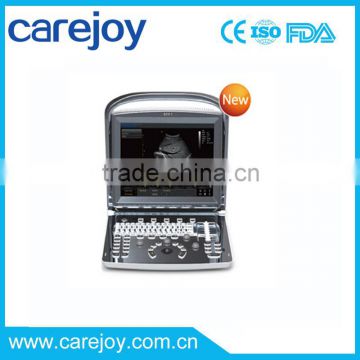 Promotion!!CE approved Portable Chison USB Ultrasound Scanner with 3.5Mhz multi-frequency convex probe ECO1