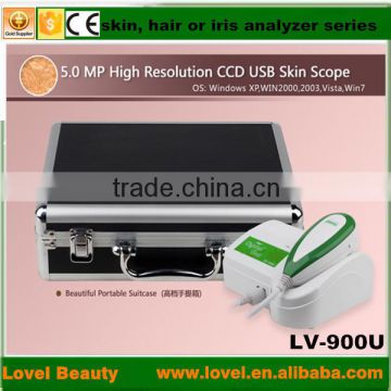 new products looking for distributor magic mirror skin scanner analyzer 5.0 MP High Resolution CCD USB skin scope