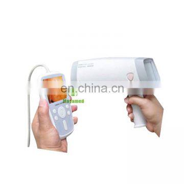 MY-F005 handheld digital electronic colposcopy