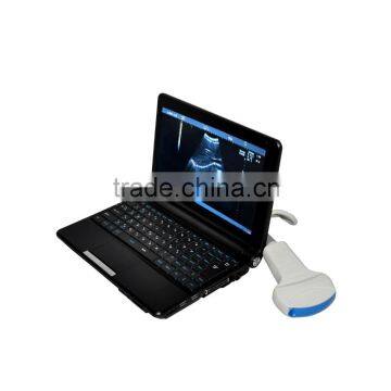 Low Factory Price!CE Approved Laptop Ultrasound Scanner RUS-9000F With 3.5Mhz Convex Probe photo-3
