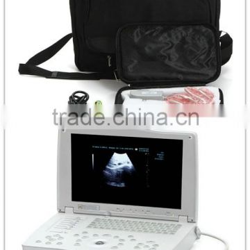 digital Laptop type Ultrasound Scanner for hospitals and clinics