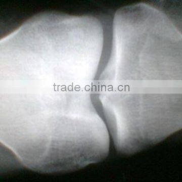 CE KND-A/F Medical Thermal x Ray Film China photo-4