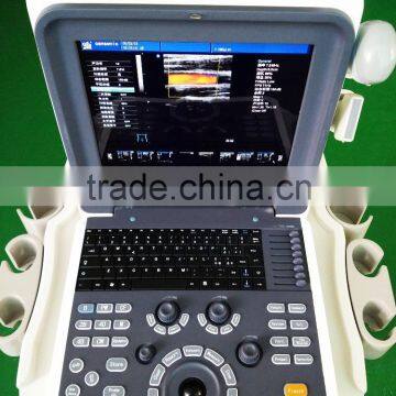 MCB-K6 Cheap 4D Color Doppler Ultrasound Scanner Machine