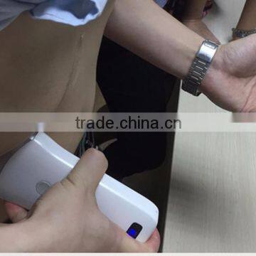 Wireless Convex Probe Scanner, WiFi, Used in Surgery Without Fixing of Cables, 3.5MHz / R40 / 64 Elements, SIFULTRAS-5.1 photo-4