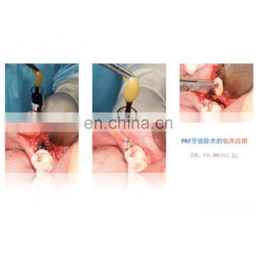 TD4A-WS Benchtop Low-speed PRP &PRF & CGF Centrifuge Machine photo-6