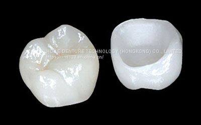 Nobel Zirconia (Porcelain Fused To Zirconia) Crown China Dental Lab