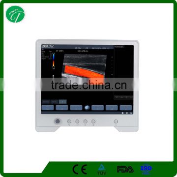 portable color ultrasound doppler system 3d ultrasound machine TS30