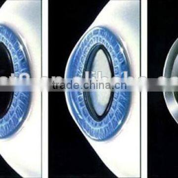 Great Ophthalmology Breakthrogh MCT Tchnology Contact lenses