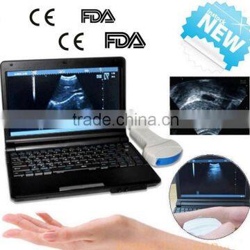 CE FDA mark 10 inch laptop Veterinary / vet Ultrasound Scanner with 3.5MHz Convex Probe rectal with USB port