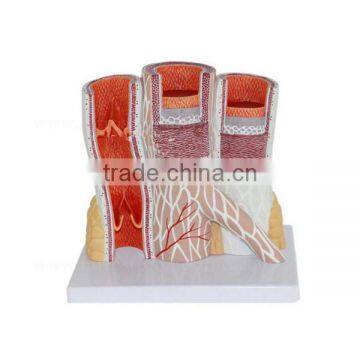 14 Times Anatomic Vascular Artery Model photo-2