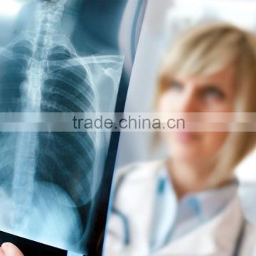 medical x-ray film agfa, agfa x-ray film 14x17 of suppliers of hospital products