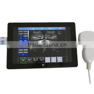 UProbe-20 Probe Type Ultrasound Scanner for Laptop photo-2