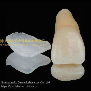 Ultra-thin Dental Veneers, Porcelain Veneer, Dental Laminates, Laboratoire Dentaire, Dentallabor, Laboratorio Dental, Dental Laboratory, Shenzhen LJ Dental Lab China