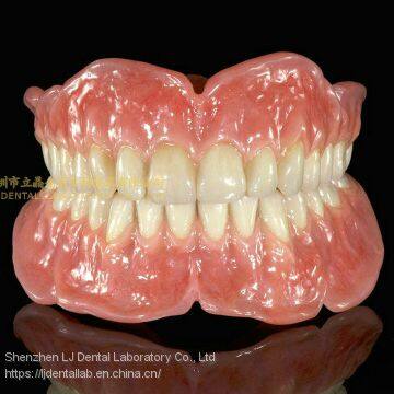 Full BPS dentures, acrylic dentures, complete denture, full dental dentures, laboratoire dentaire, Dentallabor, laboratorio dental, dental laboratory, Shenzhen LJ dental lab China