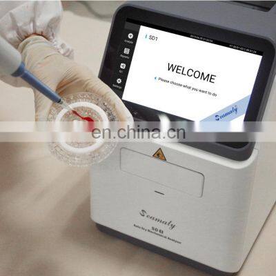 Clinical Analytical Instruments Portable Blood Chemistry Analyzer/Biochemical Analysis