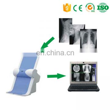 MY-D061 x-ray film digitizer