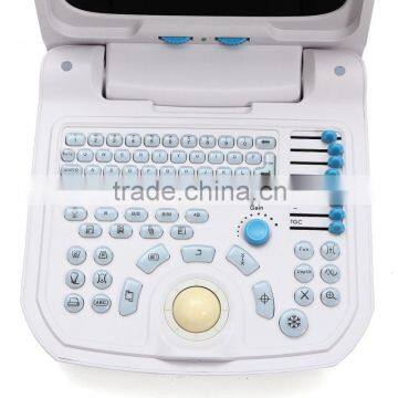 2015 New Full Digital Portable Ultrasound Scanner (PC) photo-4