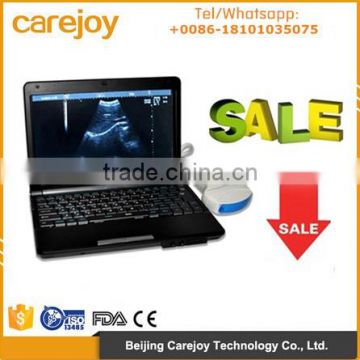 Low price Full digital Laptop Ultrasound Scanner RUS-9000F with 3.5Mhz Convex probe suitale for carrying easy