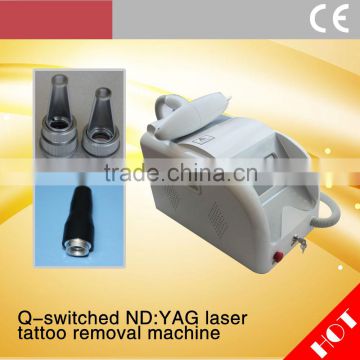 Naevus Of Ito Removal Best China Hot Sale!! Tattoo Removal Lasers Machine Q Switch In Beauty Equipment Nd Yag Laser Machine