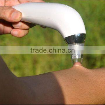 Strong Performance Skin Revitalizer!!! Blackhead Removal Microdermabrasion Machine From China photo-6