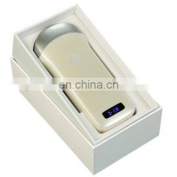 Mini Ultrasound Scan Machine / Medical Ultrasound Scanner Probe / Wireless Ultrasound photo-3