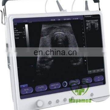 MY-A012 portable vagina images laptop ultrasound scanner price in China