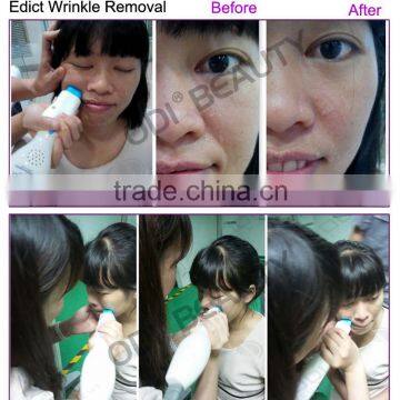 (CE Certificated) Non Surgical Mesotherapy Facial Firming Machine for Wrinkle Reduction&Fine Line Care R80 photo-3