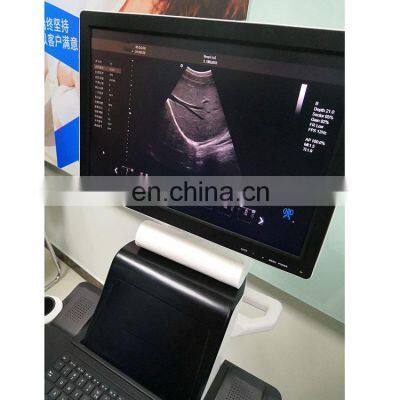 2020 Hot Sale Popular CE Certificate 4D Trolley Color Doppler Ultrasound Machine photo-3