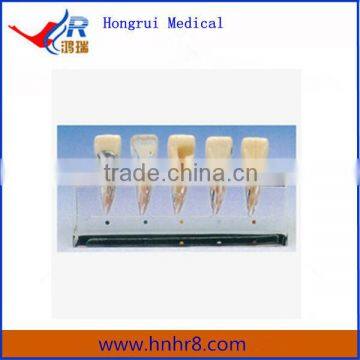 Clinical Teeth Model of Endodontics