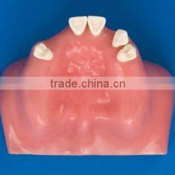 Factory Price Clinical Drill Model Cableway/ Dental Implant Model/implantes for Teeth photo-2