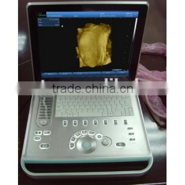 laptop ultrasound machine 3D 4D B ultrasound for pregnancy ob gyn cardiac urology small parts scanning