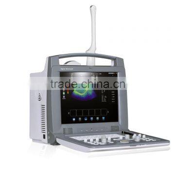 Promotion Price Cheapest 3D Laptop Color Doppler Ultrasound/doppler Ultrasound photo-3