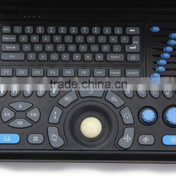China Factory Low Price Mini Laptop Portable Ultrasound Scanner Medical Price for Obstetrics and Gynecology Examine From China photo-4