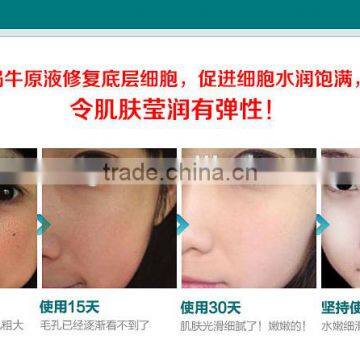 Powerful Snail Repair Serum Solution Moisturizing Remove Acne Marks Scar Skin Cell Regeneration photo-6