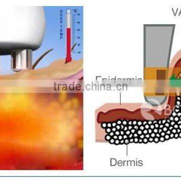 5 in 1 Ultrasund Cavitation Weight Loss Electric Body Shaper Slimming photo-5