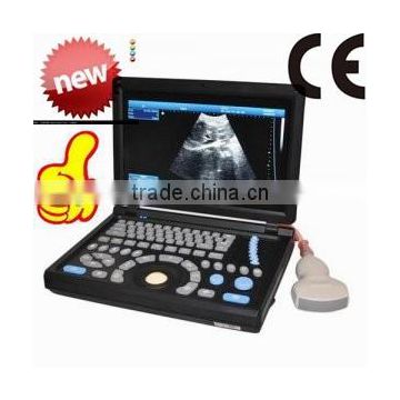 High Quality Cheap Price of Medical Handheld/Notebook/Laptop ultrasound machine with convex, linear, vaginal, rectal transducer-