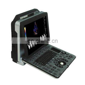 MY-A032A medical sonography machine cardiac full digital 4D color doppler ultrasound portable mobile