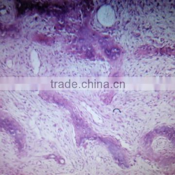 Human oral tooth pathological pathology prepared teaching slides